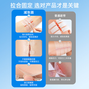 Chen Kang Medical Tension Reducing Patch Transparent Sutureless Zipper Type For Cesarean And Thyroid Surgery Wound Healing - Product Image 1
