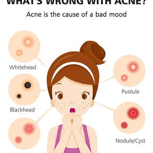 48 Parches Hidrocoloides para el Cuidado Facial, Perfeccionadores, Anti-Acné, Reparadores, Parches Invisibles para el Acné, Uso Diurno y Nocturno - Product Image 2