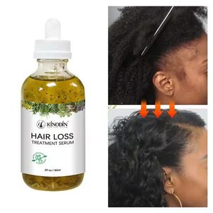 Sérum Bio Anti-Chute de Cheveux au Gingembre Extra Fort, Sans Rinçage, Huile Revitalisante <span class=keywords><strong>pour</strong></span> la Croissance Capillaire – Meilleures Ventes, Prix Abordable, Idéal <span class=keywords><strong>pour</strong></span> le Dropshipping - Product Image 5