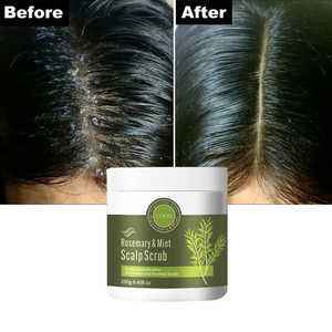 <span class=keywords><strong>Shampoo</strong></span> Antiforfora 2-in-1 con Etichetta Privata, Trattamento per la Cura del Cuoio Capelluto, Scrub Esfoliante Detox al Rosmarino e Menta Piperita - Product Image 5