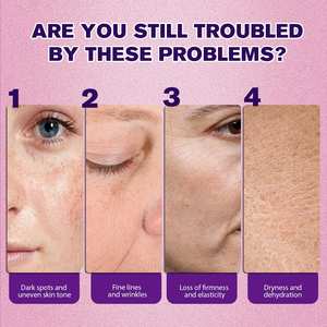 Per il retinolo antirughe e Anti-invecchiamento siero viso con vitamina <span class=keywords><strong>B3</strong></span> per idratare le rughe e macchie scure sulla pelle del viso - Product Image 3