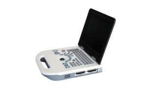 Mesin Doppler warna rumah sakit 3D, mesin <span class=keywords><strong>ultrasound</strong></span> portabel harga pabrik dengan kualitas tinggi - Product Image 4