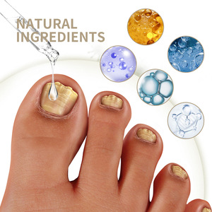 Tratamiento Herbal Antihongos <span class=keywords><strong>para</strong></span> <span class=keywords><strong>Uñas</strong></span> <span class=keywords><strong>de</strong></span> Marca Privada, Suero <span class=keywords><strong>para</strong></span> el Cuidado <span class=keywords><strong>de</strong></span> <span class=keywords><strong>los</strong></span> Pies, Onicomicosis, Paroniquia, Loción <span class=keywords><strong>para</strong></span> <span class=keywords><strong>Hongos</strong></span> en <span class=keywords><strong>las</strong></span> <span class=keywords><strong>Uñas</strong></span> - Product Image 4