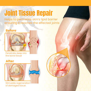 Crème efficace pour soulager la douleur au genou, nouvellement arrivée, crème supplémentaire au venin d'abeille pour le traitement des articulations et des os - Product Image 6