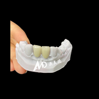 Veneers en porcelaine dentaire pour cliniques et laboratoires dentaires |   Placages en stratifié E.max sur mesure ultra-fins OEM/ODM pour un sourire éclatant