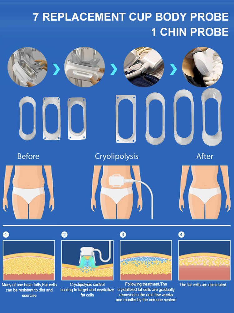 Astiland Cryolipolysis Fat Freezing Machine Spa Supplies Beauty Equipment