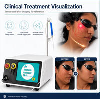 Appareil Endolaser Lift 980nm 1470nm Laser Diode pour Liposuccion Faciale, Double Menton et Corps (type Vaser)