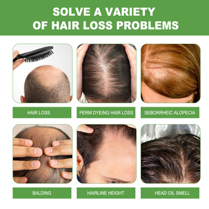 EELHOE rosmarino Shampoo professionale per la cura dei capelli pulizia profonda massaggio del cuoio capelluto idratante capelli morbidi densi funzione antiforfora - Product Image 4