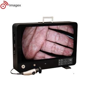 Sistema de Cámara Endoscópica Veterinaria Todo en Uno, Unidad de Cámara Endoscópica con Grabación HD e Iluminación LED para Uso Animal - Product Image 3