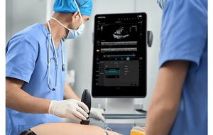 Ecógrafo Portátil Inalámbrico Mindray TE Air I3P con Wifi, Sonda de Ultrasonido de Matriz de Fases, para Uso Veterinario - Product Image 3