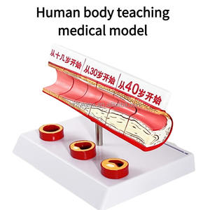Медицинские науки, возрастные сосудистые изменения ишемической болезни сердца, тромбоз, Липиды и холестерин в крови человека - Product Image 3