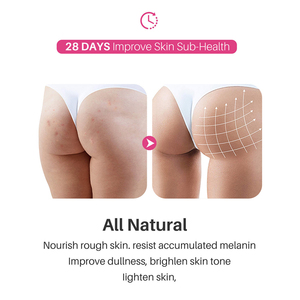 Crème anti-acné pour les fesses et les cuisses Sauvasine 50ml, lissante, hydratante, raffermissante et éclaircissante - Product Image 4