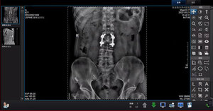 Máquina de rayos <span class=keywords><strong>x</strong></span> portátil, cofre 5KW 100mA, iray CANIS 5C, máquina de rayos <span class=keywords><strong>x</strong></span> <span class=keywords><strong>digital</strong></span> - Product Image 6