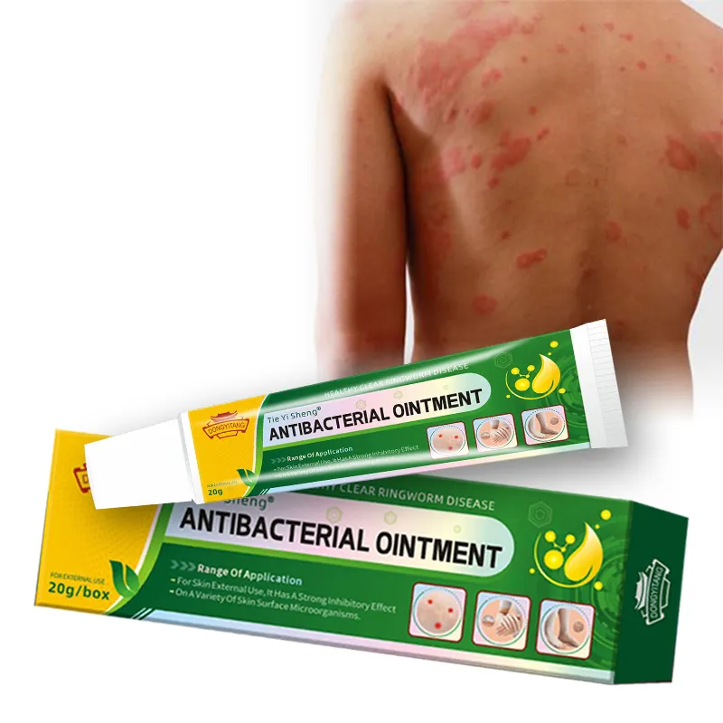 OEM/ODM salep pengobatan infeksi jamur, krim anti pruritik Dermatitis eksim