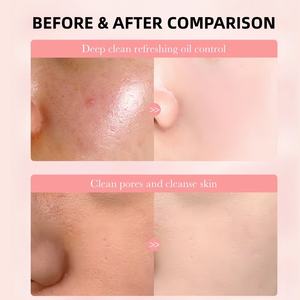 Mousse Limpiadora Nutritiva con Aminoácidos y Q10 Orgánico de 100 ml, Productos de Limpieza Refrescantes, Control de Grasa, <span class=keywords><strong>Hidratante</strong></span> y Limpieza Profunda, Venta al por Mayor - Product Image 4