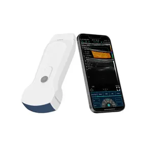 wireless wifi ultrasonido porttil con sonda convex y lineal portable ultrasound with linear and convex probe