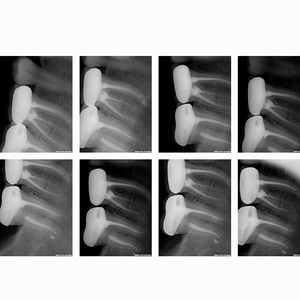 Equipo de Rayos X Veterinario Portátil, Sistema de Rayos X Digital de Baja Dosis y Alta Claridad, Precio de Fábrica - Product Image 6
