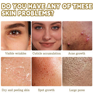 Marque privée Astringe Pores réduit les imperfections <span class=keywords><strong>de</strong></span> la peau Toner Pad Peau rougeoyante Acide glycolique 7% Tonique exfoliant pour le visage - Product Image 5