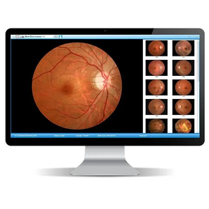 China oftalmal Retina Camera SK-650B Eye Test Camera Retina Fundus Camera - Product Image 6