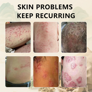 Ungüento herbario para la picazón en las partes íntimas <span class=keywords><strong>de</strong></span> hombres y mujeres, ungüento para el eczema, ungüento para infecciones fúngicas, producto estrella del fabricante. - Product Image 4