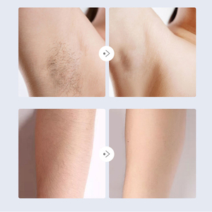 Rasoir 2 en 1 pour femmes, épilateur multifonction - Product Image 5