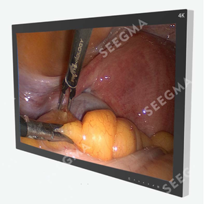 จอแสดงผลสำหรับการผ่าตัดแบบส่องกล้องคุณภาพสูง ขนาด 27 นิ้ว 32 นิ้ว 55 นิ้ว สำหรับใช้ในโรงพยาบาล เครื่องมือไฟฟ้า - Product Image 6