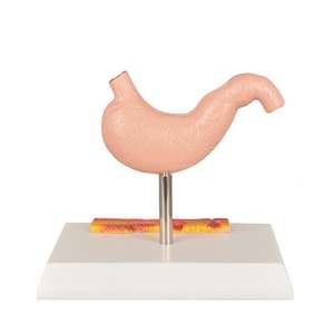 Modèle d'enseignement médical Modèle de démonstration d'évolution de l'estomac pathologique, outil anatomique en PVC pour la formation en gastroentérologie - Product Image 5