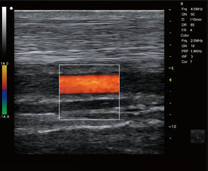 Koeien Paard Reproductie Diagnose Echografie Instrument Grote Dieren Reproductieve Scanner Handheld Dierenarts <span class=keywords><strong>Ultrasound</strong></span> Draadloze - Product Image 5