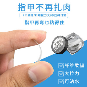 In-stock ingrown toenail correction <b>kit</b>, including <b>nail</b> grafts, <b>nail</b> groove pliers, and <b>nail</b> wires for correcting toenails. - Product Image 3