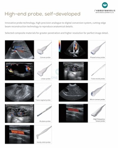 TC-6T ONETECH Appareil d'échographie obstétricale 2D/4D/5D homologué CE avec sonde convexe linéaire cardiaque pour l'analyse de la thyroïde - Product Image 6