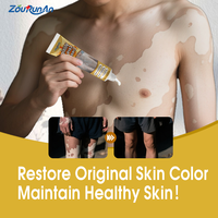 Crème de traitement au extrait d'herbes Zourunan pour le vitiligo, élimination de la teigne et des taches blanches, pommade contre le vitiligo
