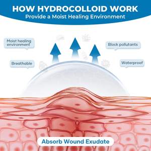 Rollo de hidrocoloide cortado a medida Vendajes para el cuidado de heridas Acné Espinilla - Product Image 5