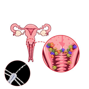 Home <strong>Use</strong> Vagina Cleaning Hygiene Irrigation Unisex Vaginal Anal <strong>Douche</strong> Bottle <strong>Enema</strong> Bulb Kit - Product Image 3