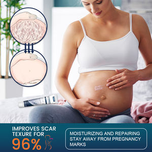 Krim penghilang bekas luka <span class=keywords><strong>Herbal</strong></span>, Krim penghilang Stretch Mark, perawatan perbaikan 20G, cepat - Product Image 5