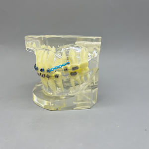 โมเดลการสาธิตการจัดฟันพร้อมสายรัดและแถบยางสำหรับคลินิกทันตกรรมและการสื่อสารกับผู้ป่วย - Product Image 2