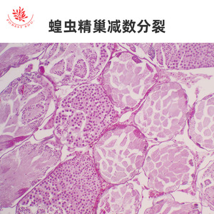 Mitosis de células animales (por ejemplo, huevos de lombrigas equinas); mitosis de puntas de raíz de plantas (objetivo microscópico) - Product Image 3