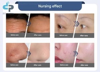 Appareil de soin du visage Hydra à bulles multifonctionnel, nettoyage en profondeur à l'eau et à l'oxygène, rajeunissement de la peau, équipement de beauté EU/US