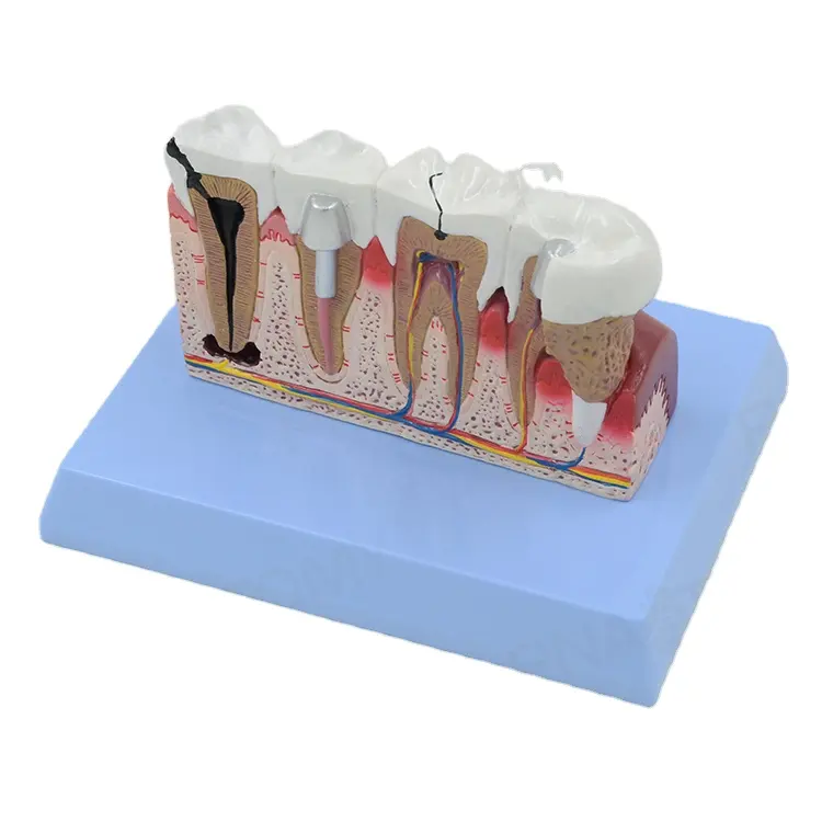 Dental Teeth models and Implants Communication Model for Dentist tooth model