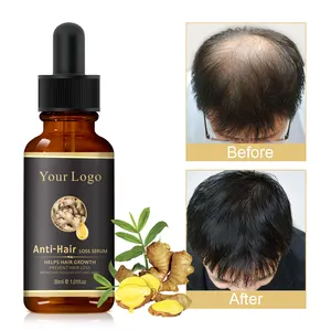Sérum Anti-chute de cheveux OEM ODM, huile de sérum pour traitement des cheveux, Essence de gingembre naturelle et biologique