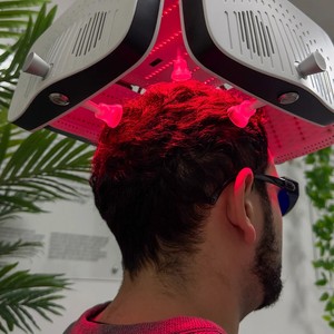 Dispositivo de crecimiento de cabello con láser de diodo 424 para <span class=keywords><strong>alopecia</strong></span> androgenética CE EE. UU. 510K Salón aprobado y clínicas de Dermatología - Product Image 4