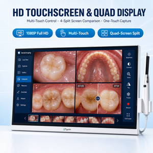 <strong>Intra</strong> Oral Camera Dental with Touch Screen 23.8 Inch - Product Image 4