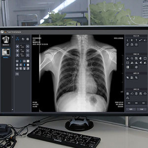 全身撮影用デジタル<span class=keywords><strong>X</strong></span>線装置 ダブルコラム<span class=keywords><strong>X</strong></span>線装置 500MA医療用<span class=keywords><strong>X</strong></span>線装置 - Product Image 4