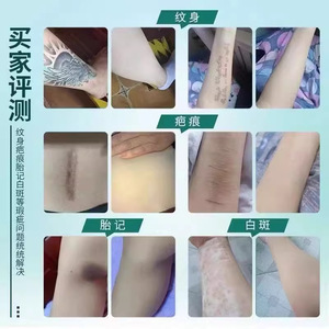 Patch corporel en silicone pour tatouage, cicatrice, tache de naissance – Couvrant, ton de peau naturel, imperméable, fin, correcteur - Product Image 1