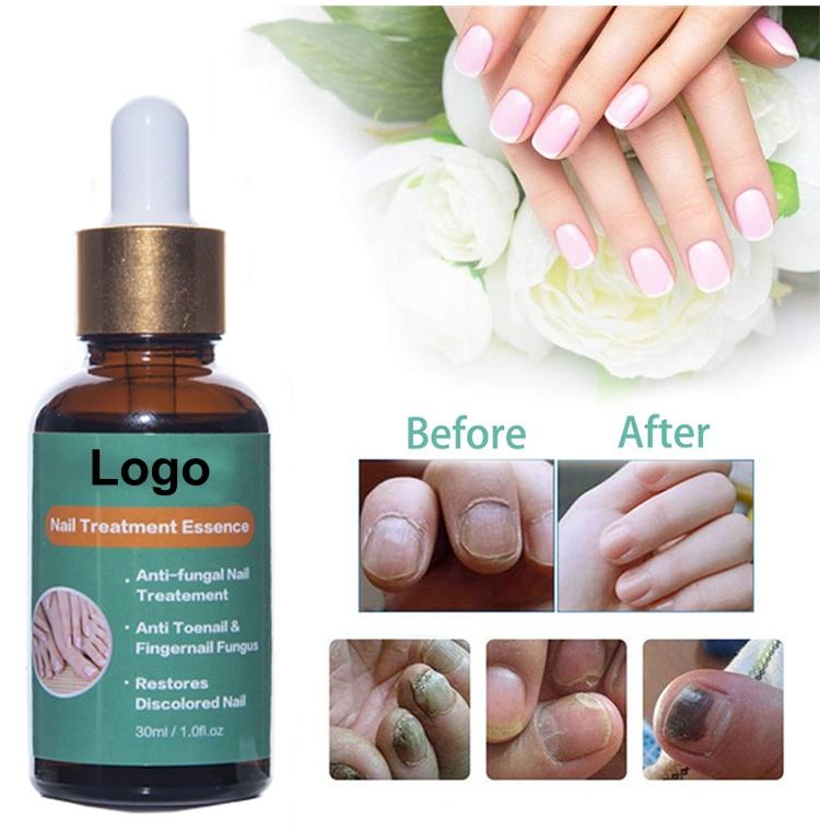 Esencia de tratamiento de uñas