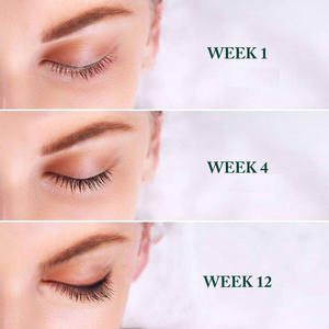 Suero para el Crecimiento <span class=keywords><strong>de</strong></span> Pestañas <span class=keywords><strong>de</strong></span> 5 ml, Estimulante <span class=keywords><strong>de</strong></span> Pestañas para Pestañas Más Largas, Gruesas y Voluminosas, Potenciador <span class=keywords><strong>de</strong></span> Pestañas Natural y Suave - Product Image 5