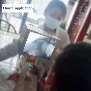 Sistema de Fluoroscopia Portátil Equivalente a Rayos X para Animales, Máquina de Rayos X Portátil Médica - Product Image 6