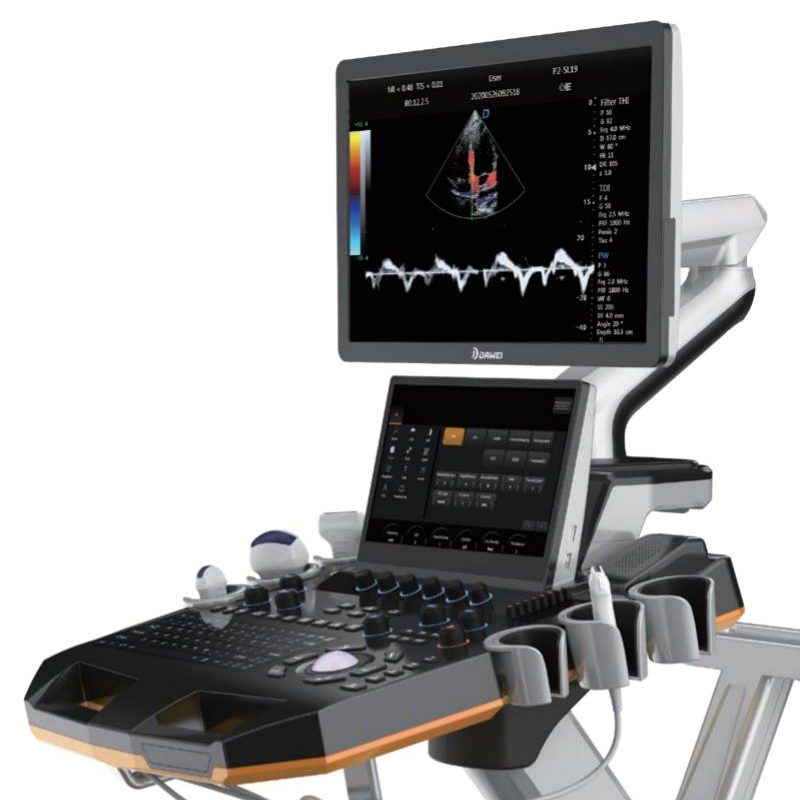 MN-Ultra8 Laptop Cart Ultrasonic Color Scanner Portable Ultrasonic Affordable Ultrasonic Scanner