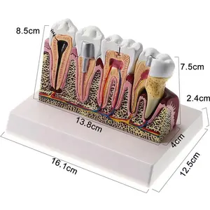 Beliebte Zahn lehre im westlichen Stil Demonstration modell Dental Anatom ical Model