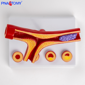 Modèle de thrombus artériel à 5 composants Occlusion <span class=keywords><strong>vasculaire</strong></span> plastique et <span class=keywords><strong>pathologie</strong></span> athéroscléreuse - Product Image 3