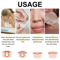 Patchs nasaux en hydrogel, étiquette privée OEM, pour nettoyer en profondeur les Pores du nez, élimine l'acné et les points noirs, pièces